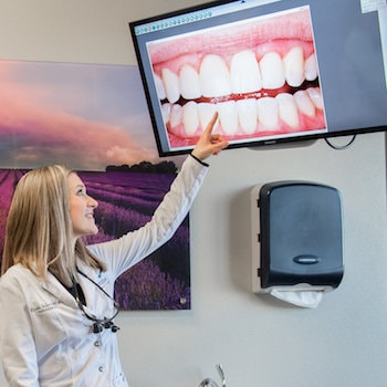 Teeth shown on a screen to demonstrate how sealants can help as part of family dentistry