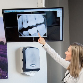 X-rays shown on a large screen in our family dentistry office