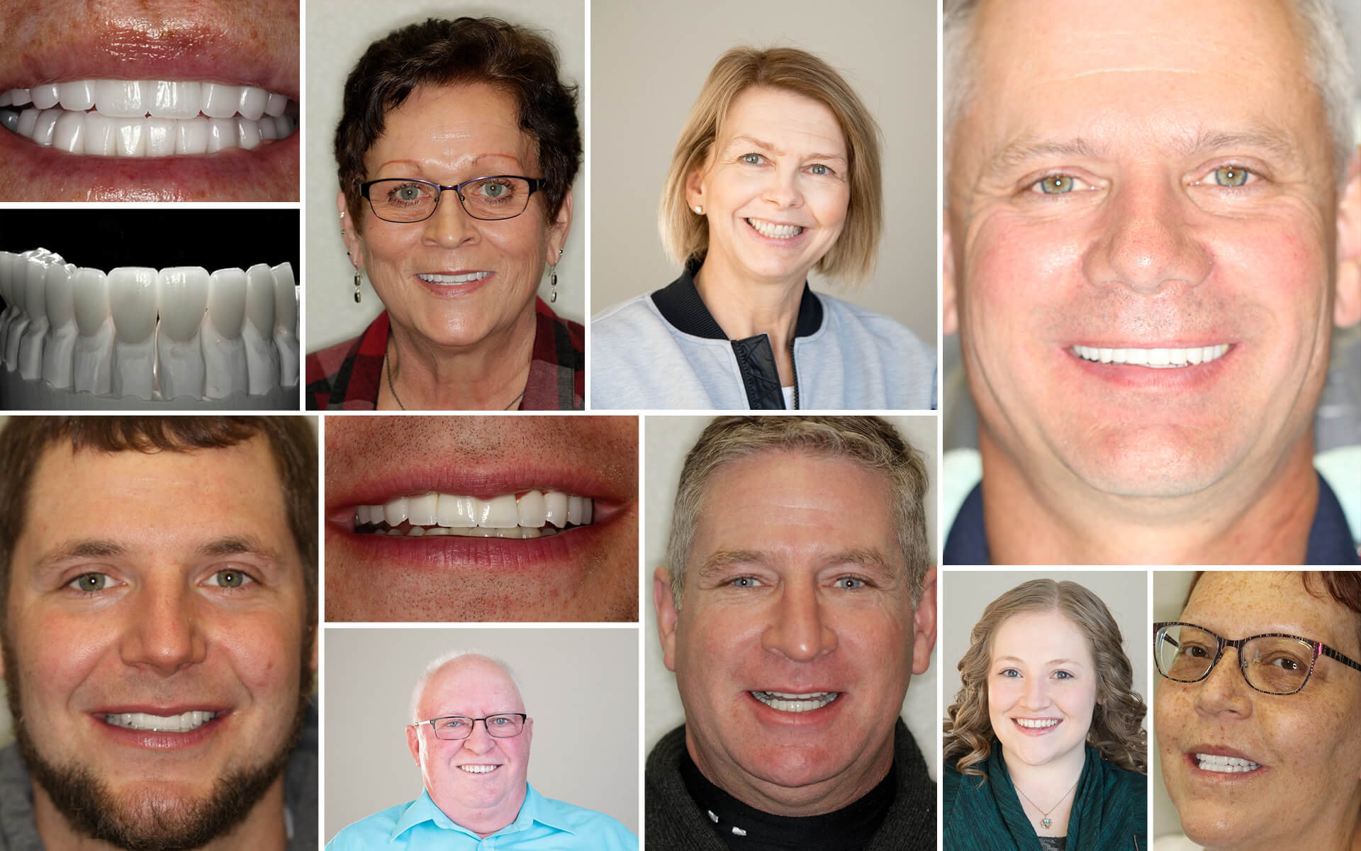 Collage of Bismarck Cosmetic Dentistry Work Before and Afters
