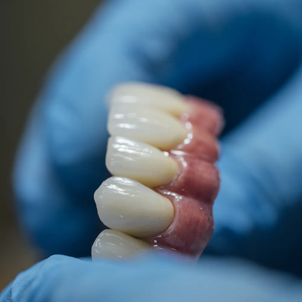 All On 4 Dental Implants Full Arch Zirconia